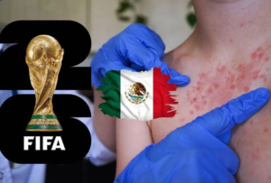 MC presumió un Mundial de primer nivel, pero dejó a Jalisco entre los estados con más casos de sarampión
